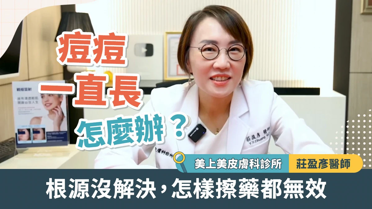 痘痘一直長怎麼辦？莊盈彥醫師：根源沒解決 怎樣擦藥都無效